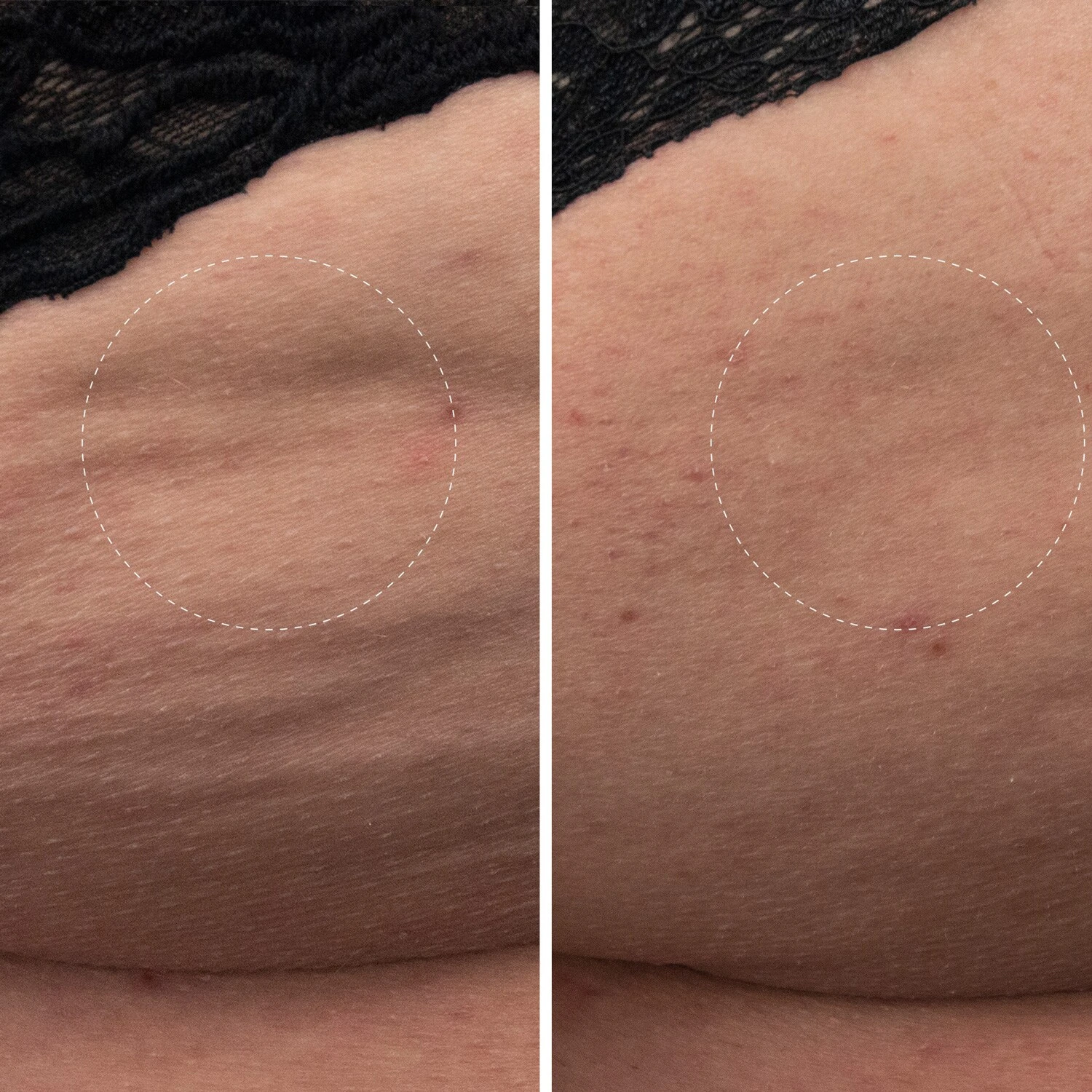 Augustinus Bader The Body Cream - Crème Hydratante Pour Le Corps 7 Augustinus Bader The Body Cream - Crème Hydratante Pour Le Corps – Image 5