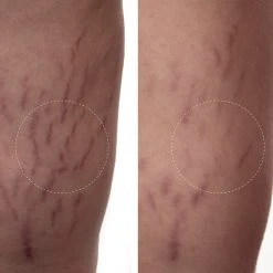 Augustinus Bader The Body Cream - Crème Hydratante Pour Le Corps 13 Augustinus Bader The Body Cream - Crème Hydratante Pour Le Corps -Sephora shop P10045419 5