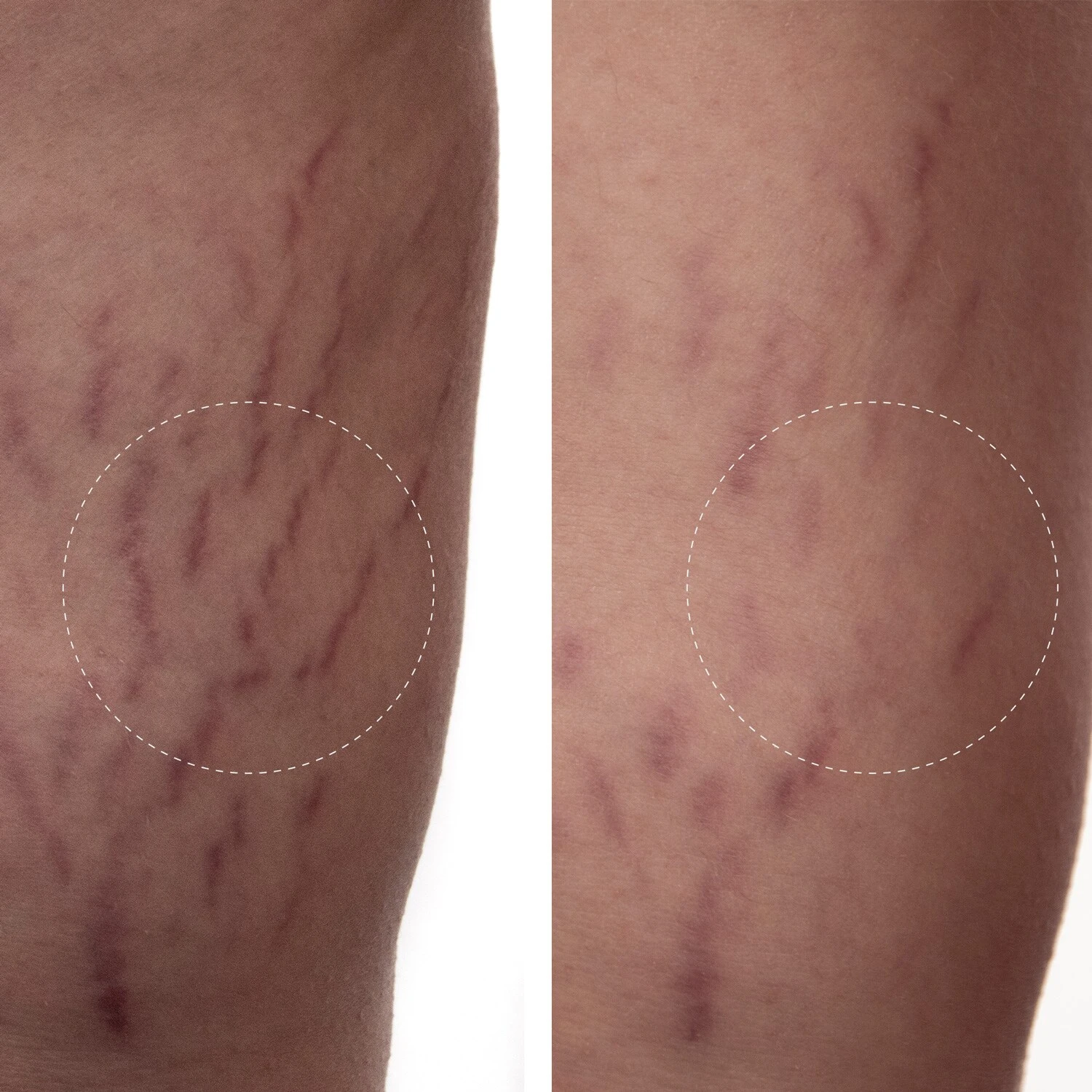 Augustinus Bader The Body Cream - Crème Hydratante Pour Le Corps 8 Augustinus Bader The Body Cream - Crème Hydratante Pour Le Corps – Image 6