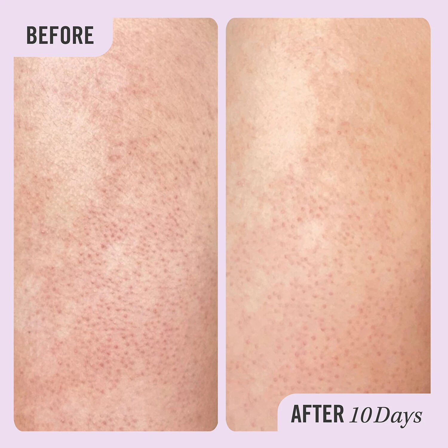 First Aid Beauty FAB Body Besties - Coffret Soin Corps 5 First Aid Beauty FAB Body Besties - Coffret Soin Corps – Image 3